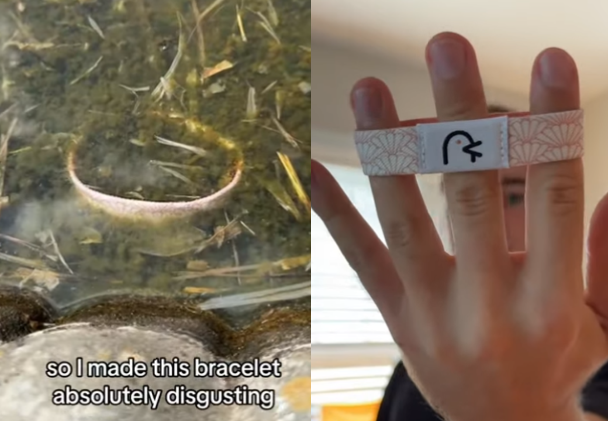 before and after contrast