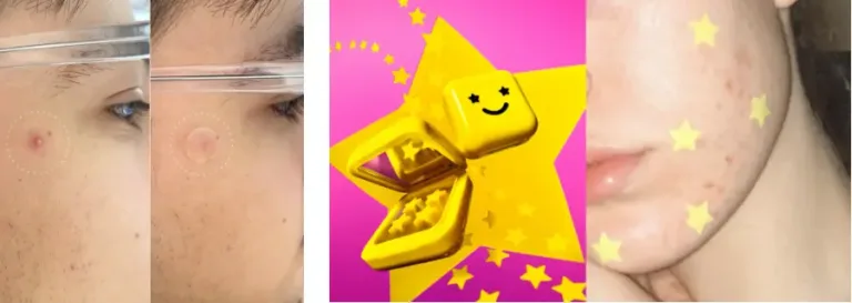 Starface pimple sticker