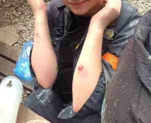 children injured by paintball
